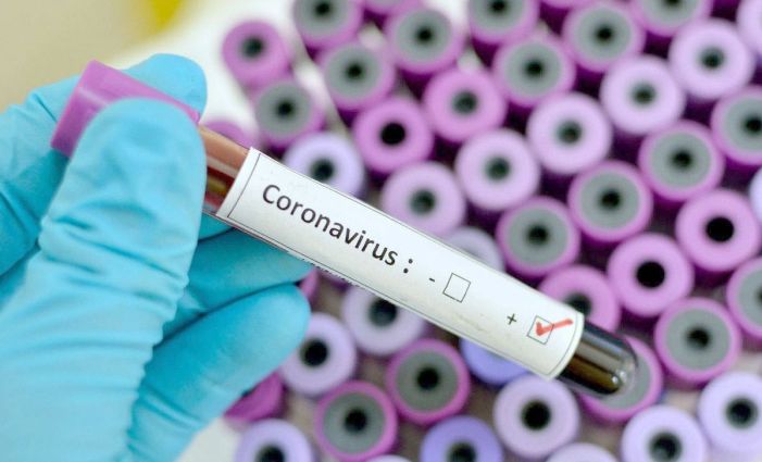 Bolster your immune system to battle coronavirus