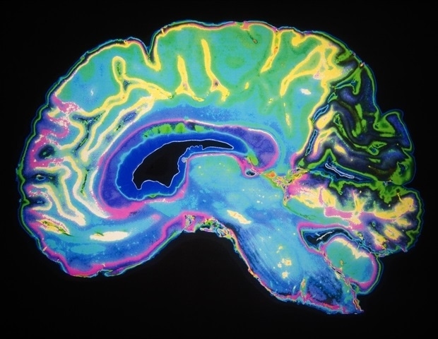 Study tracks neurological symptoms in COVID-19 "long-haulers"